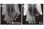 リン酸八カルシウム（OCP）／コラーゲン複合体創製による骨再生への応用