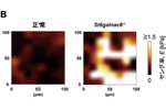 力学に基づく臓器疾病の機序解明